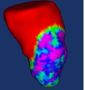 Cardiac functional assessment